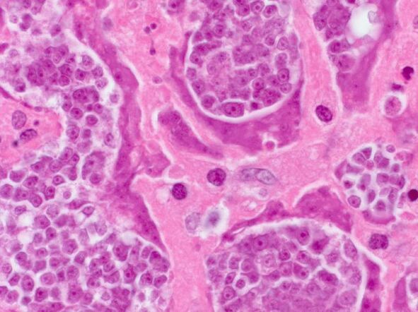 Fuerschung vu Parasiten an enger Persoun