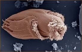 Pathogenesch Mikroorganismen an Mënschen