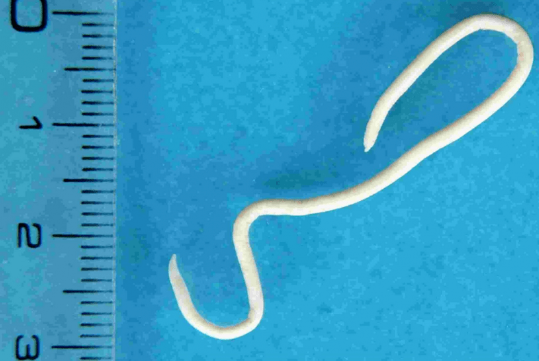 Beschreiwung vun mënschleche Parasiten
