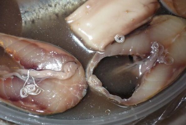 Weeër vu Mënsch Infektioun duerch Parasiten