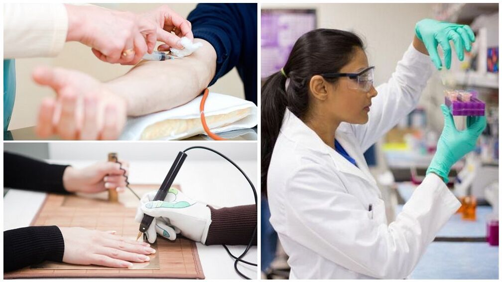 Diagnostesch Methoden fir Parasiten am Kierper z'entdecken