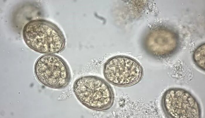 Parasiten ënner engem Mikroskop