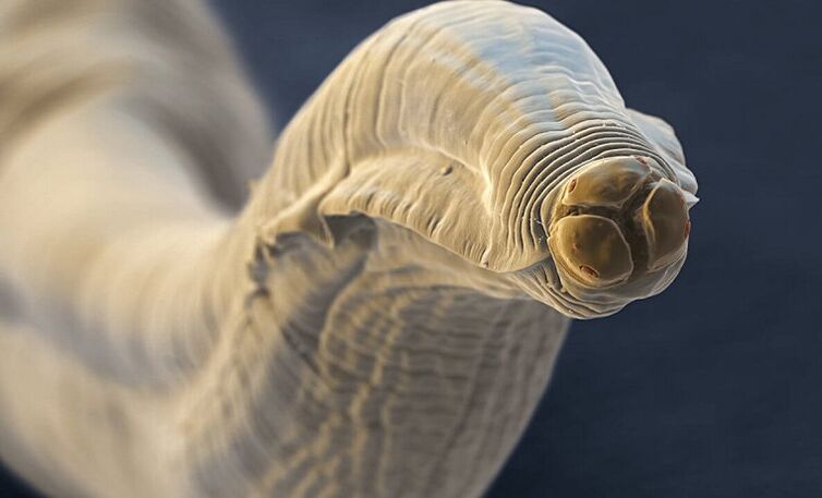 Wurmparasit aus dem mënschleche Kierper