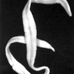 Ribbon Parasiten am mënschleche Kierper