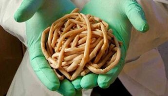 Methoden vun Eliminatioun vu Parasiten aus dem Kierper