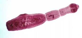 Wéi kritt een d'Parasiten am mënschleche Kierper lass