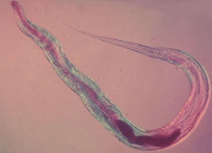 Pinworm ënner engem Mikroskop