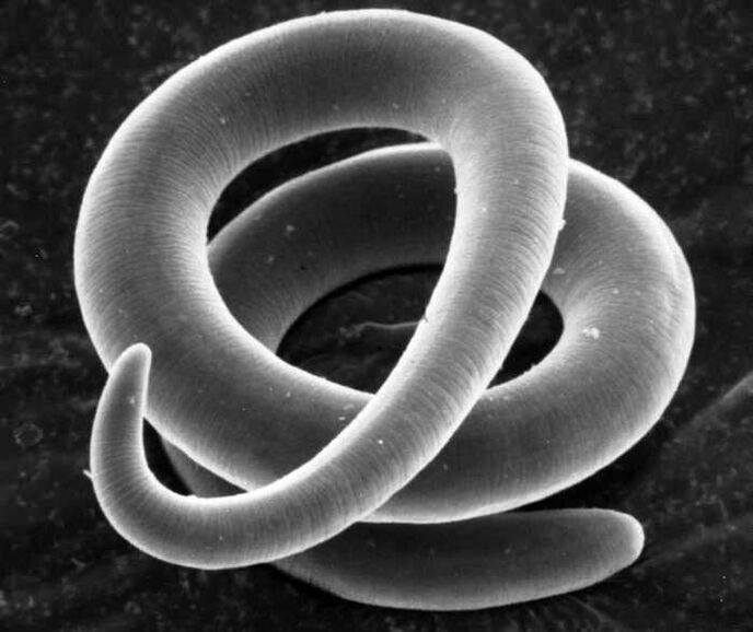 Trichinella ënner engem Mikroskop